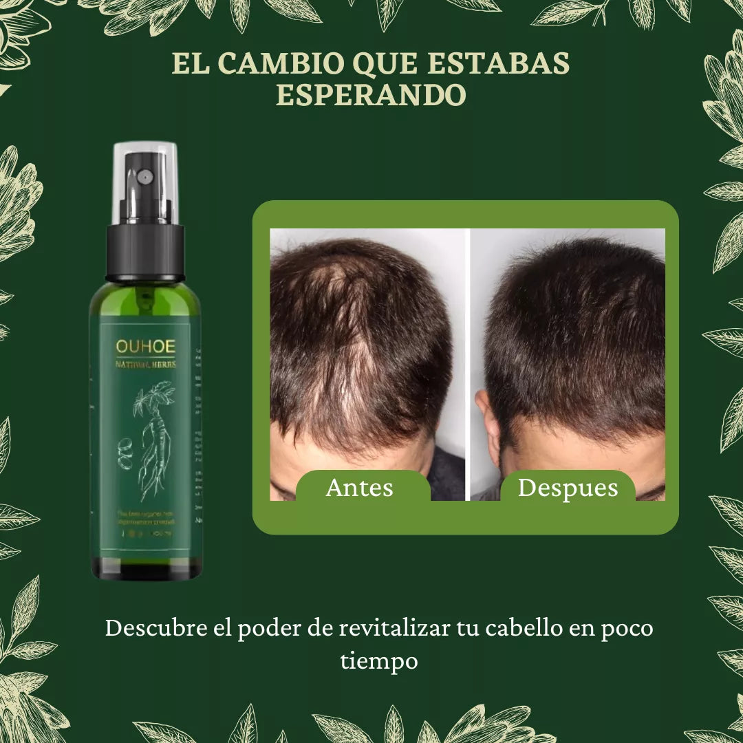 OUHOE® | Spray Para El Crecimiento Natural del Cabello