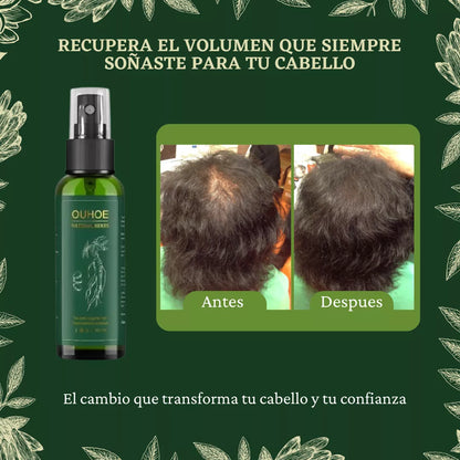 OUHOE® | Spray Para El Crecimiento Natural del Cabello